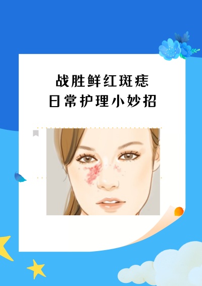 鲜红斑痣能不能彻底治好？